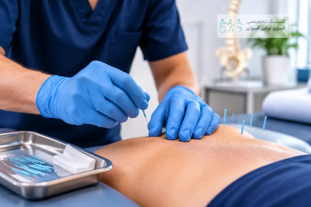 طب سوزنی خشک