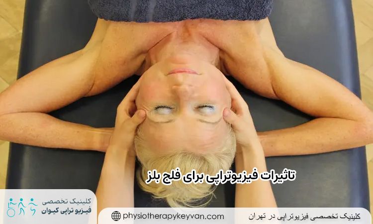 تاثیرات فیزیوتراپی برای فلج بلز 