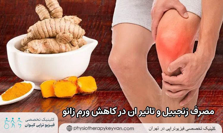 مصرف زنجبیل و تاثیر ان در کاهش ورم زانو