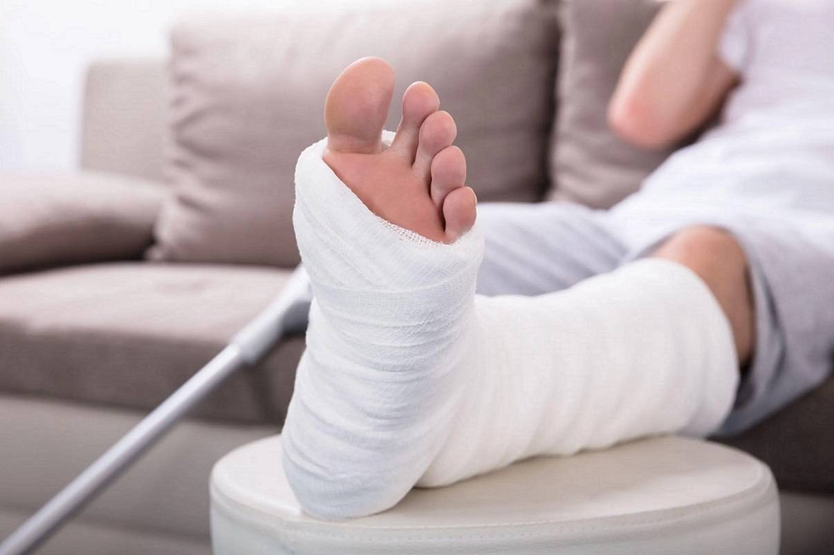 بررسی عوارض زود باز کردن گچ پا