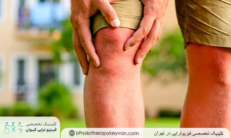 درمان قطعی ساییدگی کشکک زانو
