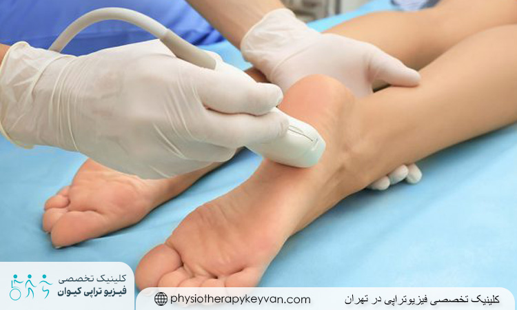 فیزیوتراپی برای نوروپاتی