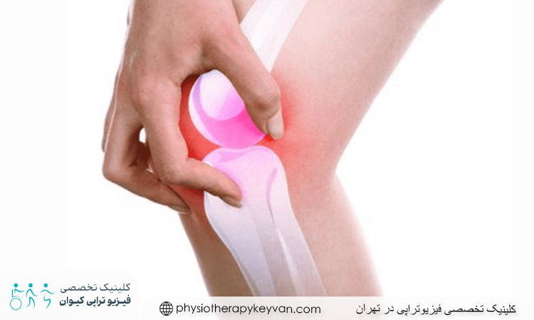 آیا نرمی غضروف زانو درمان قطعی دارد؟