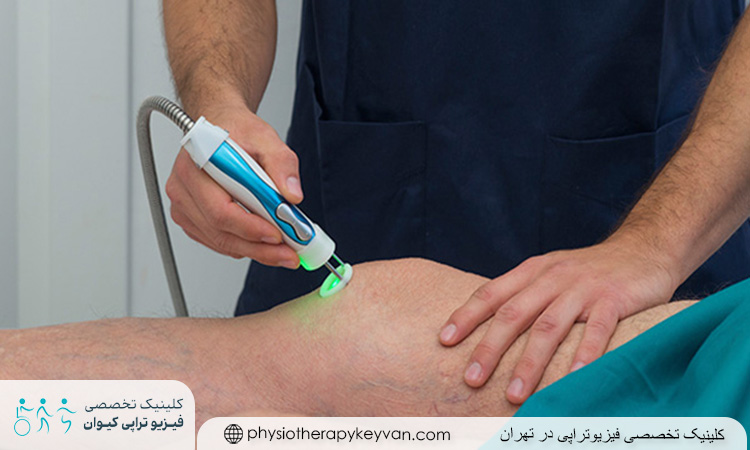بهترین روش های فیزیوتراپی برای زانو فوتبالیست