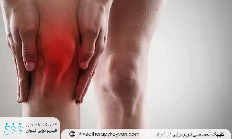 روش‌های درمانی آب آوردن زانو