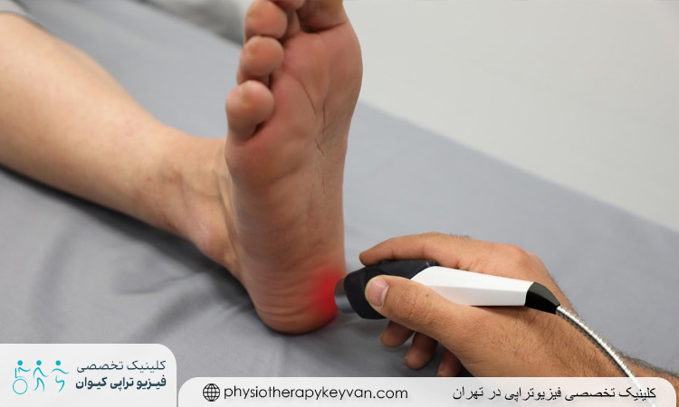 فیزیوتراپی برای خار پاشنه