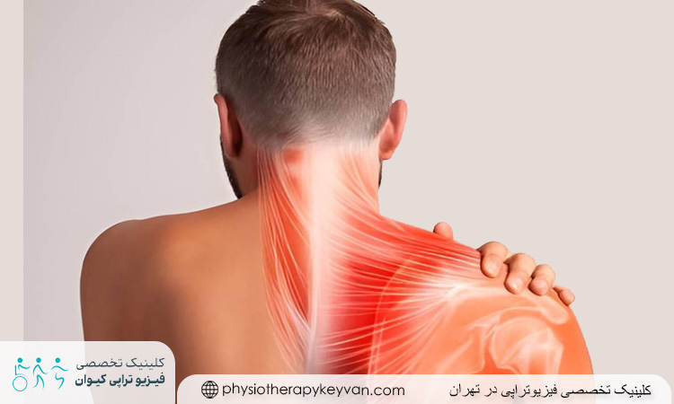 علت درد عضلانی شانه و گردن