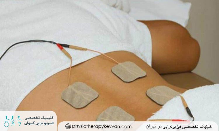 فیزیوتراپی دیسک کمر