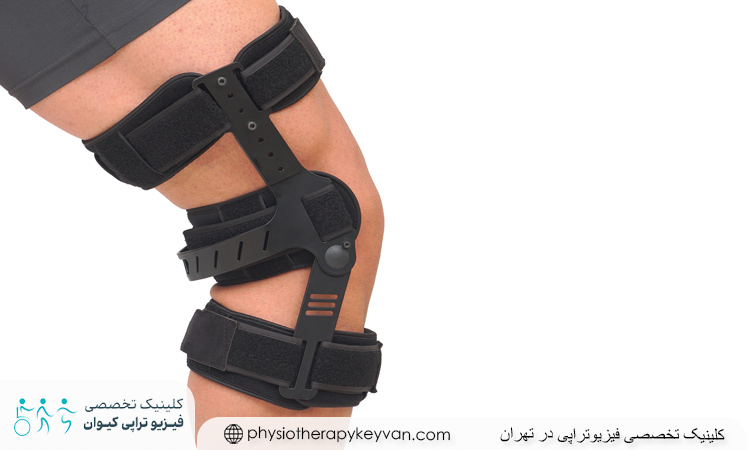 تفاوت پای پرانتزی و ضربدری چیست؟ 3 درمان پای پرانتزی