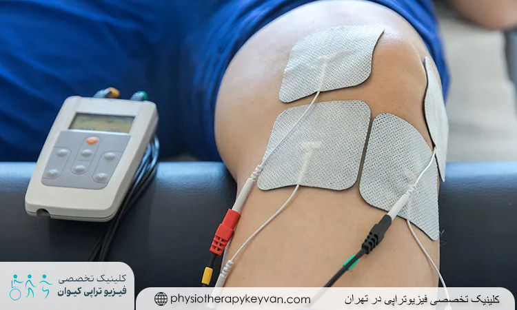 هزینه فیزیوتراپی رباط صلیبی 