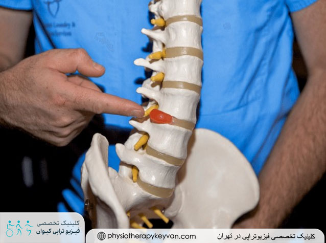 در چه شرایطی تحرک و کوهنوری برای دیسک کمر مضر نیست؟