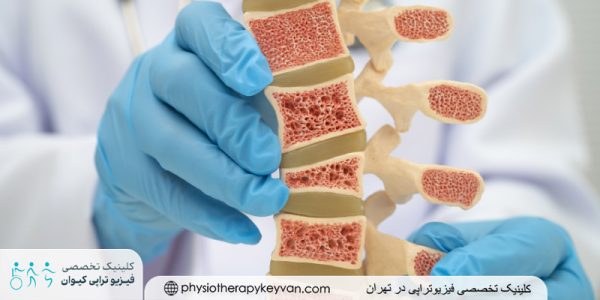 فیزیوتراپی پوکی استخوان 2 پوکی استخوان