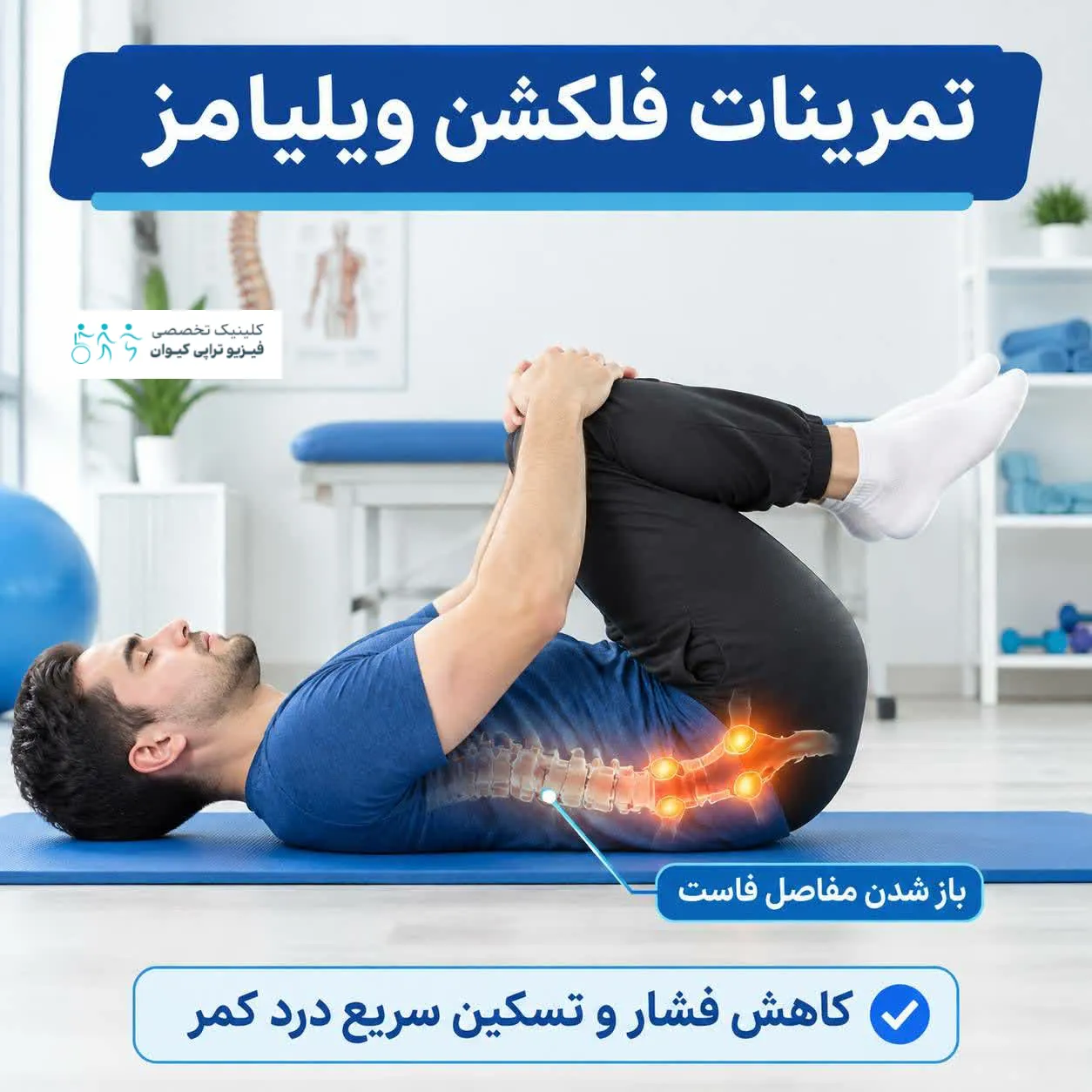 سندروم مفاصل فاست کمر 6 تمرینات فلکشن ویلیامز