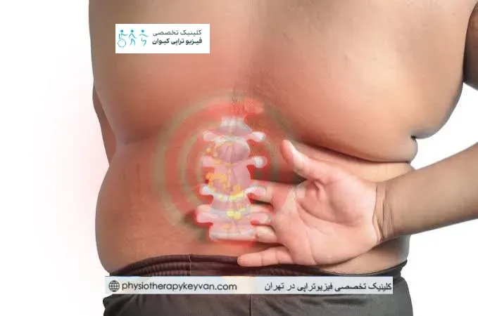اضافه وزن و جراحی ستون فقرات | فیزیوتراپی قبل و بعد از عمل 3 مهم ترین خطرات اضافه وزن در جراحی ستون فقرات