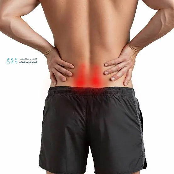 سندروم مفاصل فاست کمر 5 watermarked image 4 9