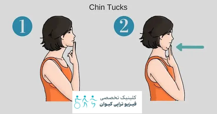 تمرین عقب کشیدن چانه
