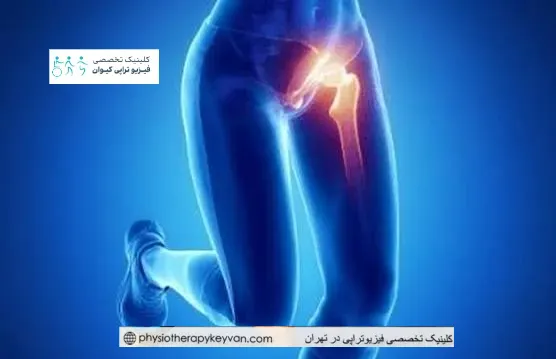 علت های درد کشاله ران 3 علت درد کشاله ران در زنان