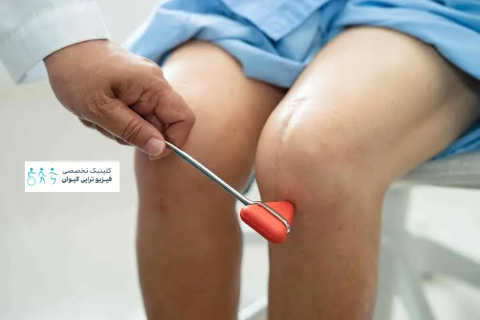زانو ضربدری | بررسی علائم و بهترین روش های درمان 4 عوارض ناشی از درمان نکردن زانوی ضربدری