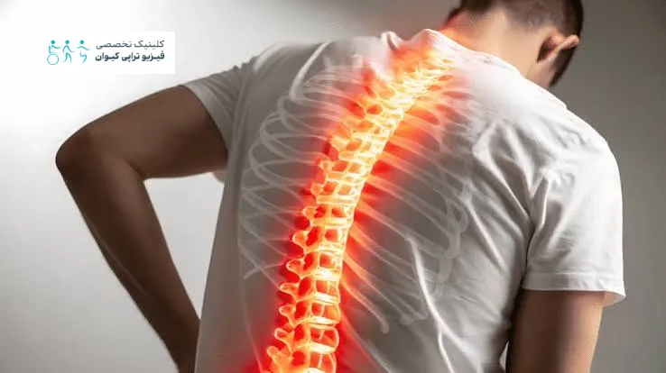 تاثیر استرس روی ستون فقرات 5 چه زمانی درد ستون مهره ها اورژانسی و جز علائم خطر است؟