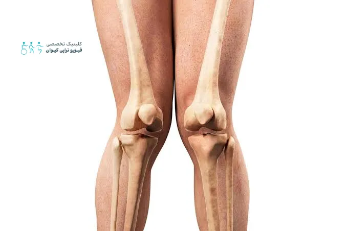 زانو ضربدری