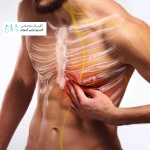 فرورفتگی دنده | نشانه، تشخیص و راهنمای کامل درمان 2 بررسی فرورفتگی دنده و تفاوت با سینه قیفی شکل