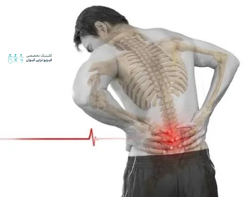 خشکی و کم آبی دیسک کمر