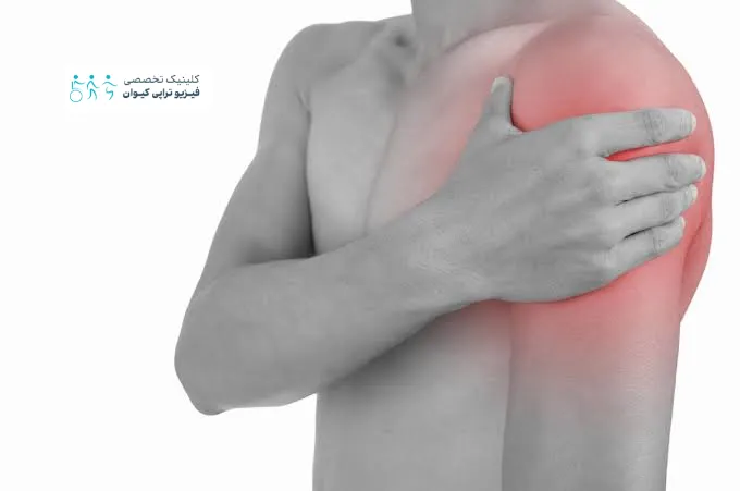 مهم ترین علت های درد بازو + روش درمان و فیزیوتراپی 4 درد بازوی چپ چه وقت نشان دهنده مشکل قلبی است؟